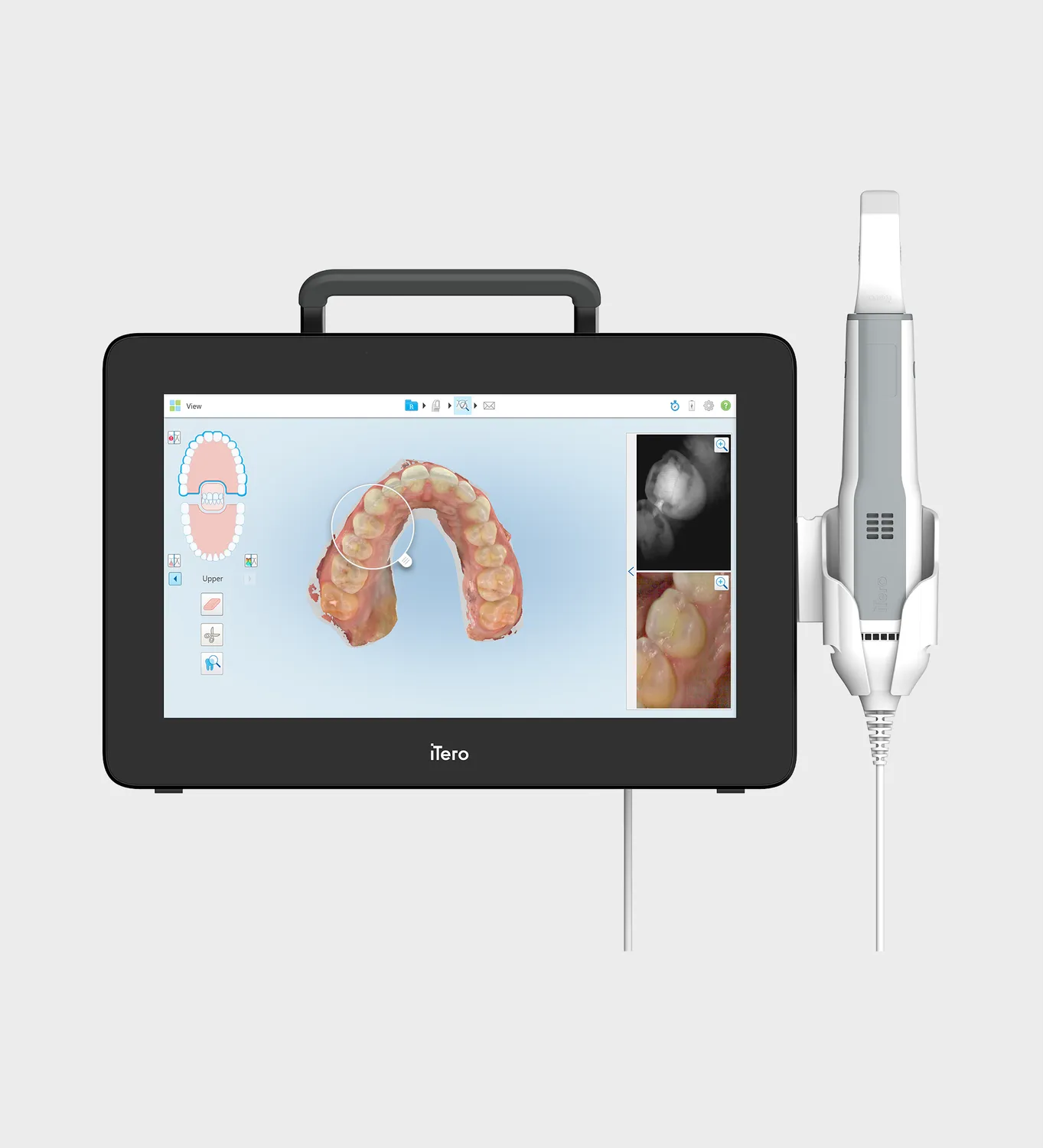 iTero Element 5D Plus Mobile Scanner Scanner 1 Monat Testangebot