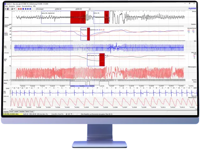 GETEMED VitaWin 3.4 Auswertesoftware für VitaGuard