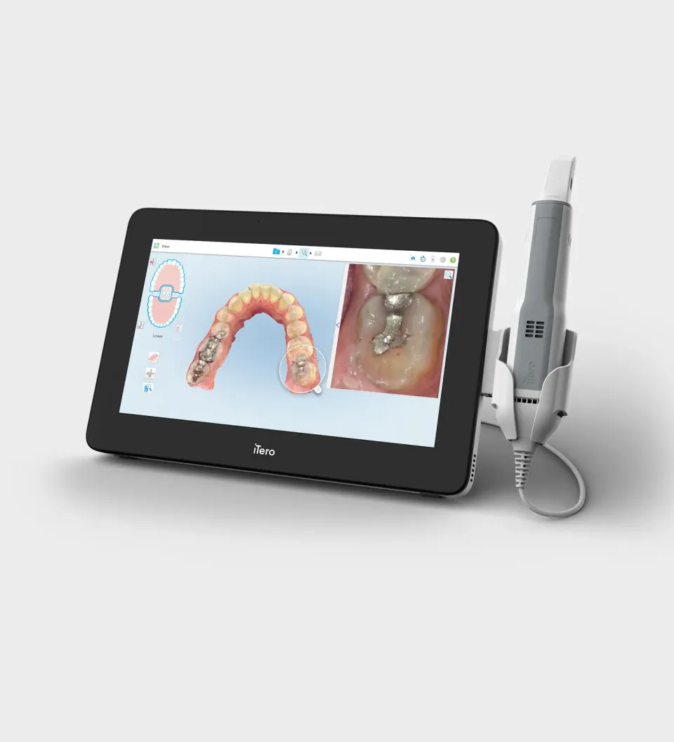 iTero Element 5D Plus Mobile Scanner Scanner 1 Monat Testangebot